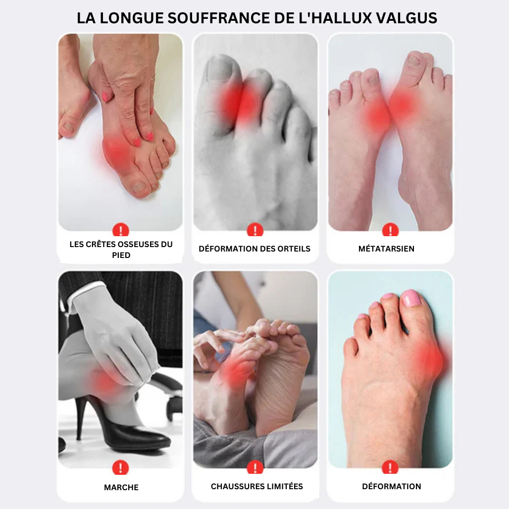 Chaussettes Correctrices pour Hallux Valgus