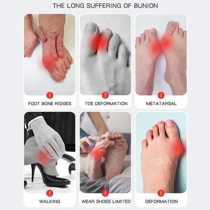 Bunion Corrector Socks